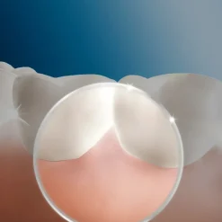 Oral-B Professional Care OxyJet Munddusche inkl. 2 Ersatzaufsätze